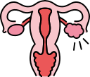 PCOS
